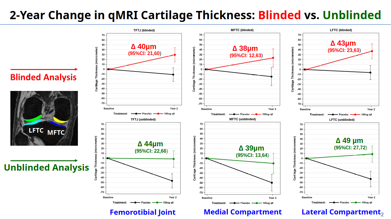 Automated Analysis of Cartilage