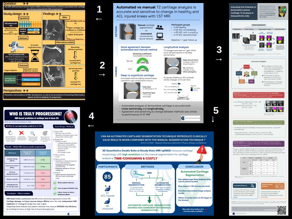 Automated Analysis of Cartilage