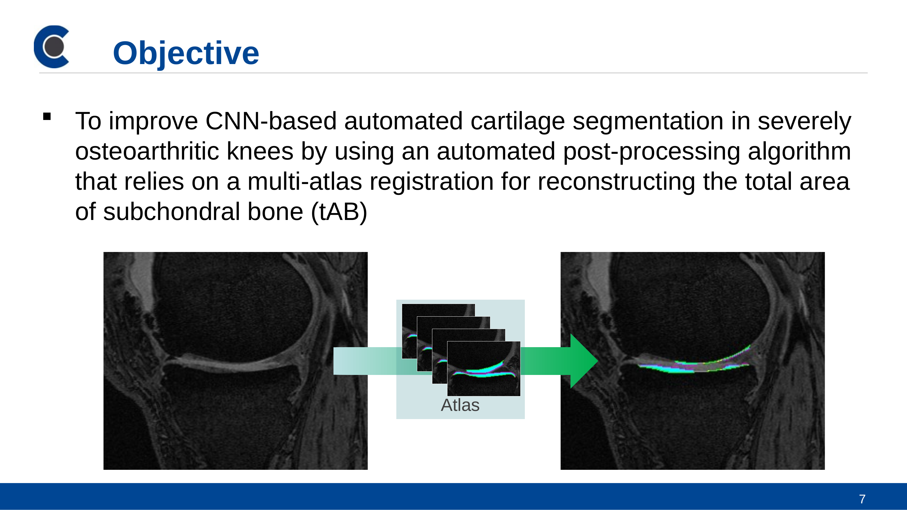 Automated Analysis of Cartilage